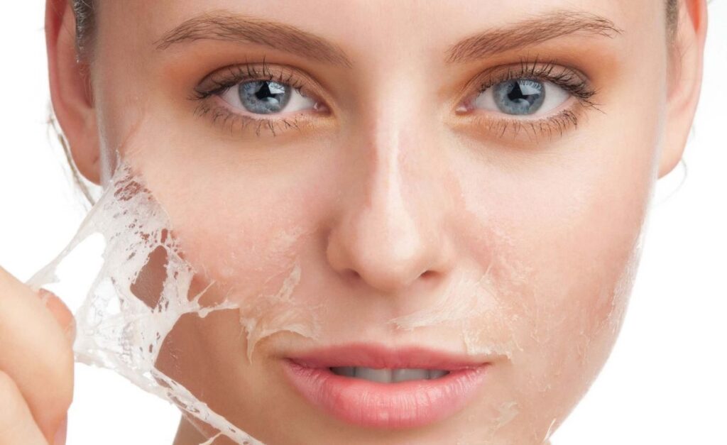 Cómo rejuvenecer la piel con peeling químico