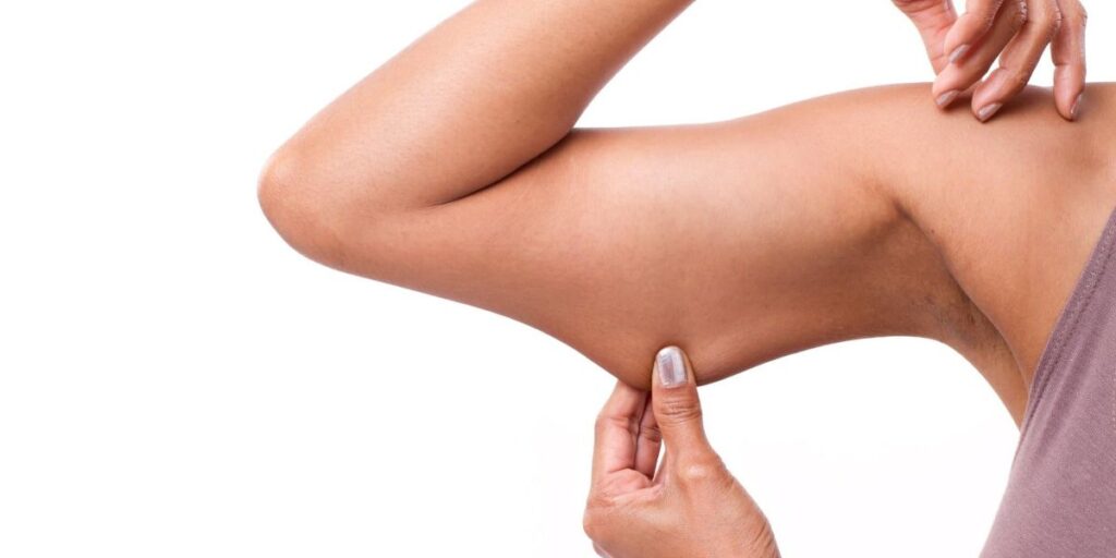 Beneficios del lifting de brazos (braquioplastia)