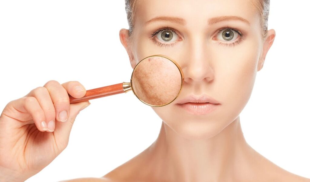 Tratamientos para eliminar manchas cutáneas y melasma
