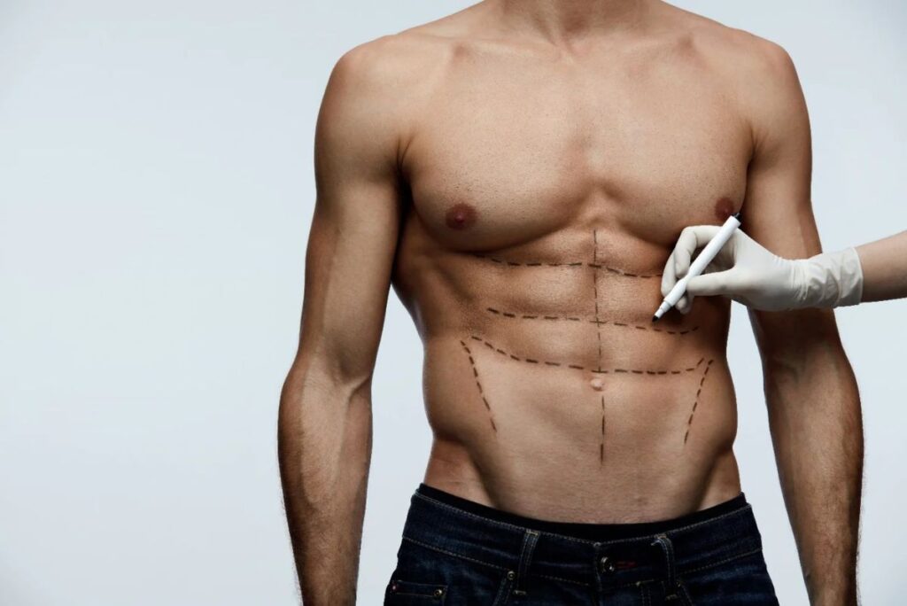 Cirugía estética masculina: tendencias y demanda creciente